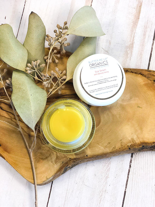 An open jar of yellow butter-like cream labeled "White Smokey Scar Serum" is placed on a wooden plank with dried eucalyptus leaves and seeds, highlighting the essence of Manuka Honey in organic skincare.